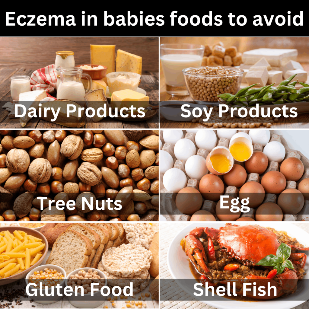 Eczema in babies food to avoid