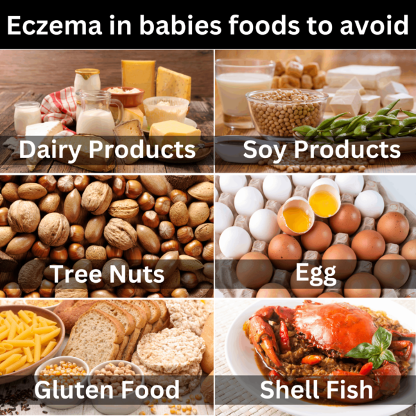 Foods that cause eczema in babies